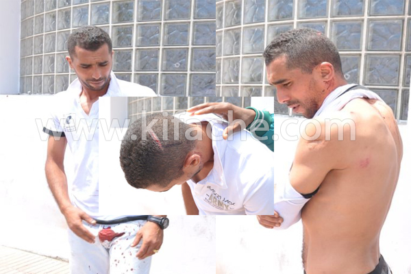 بالفيديو والصور.. الاعتداء على حمزة بورزوق بآلة حادة ونقله المستشفى