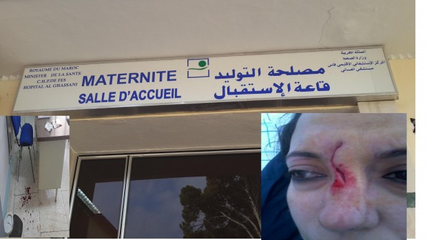 مستشفى الغساني في فاس.. الاعتداء على مولدة