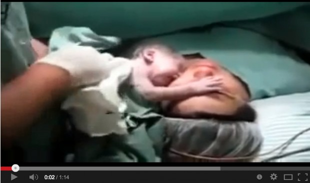 فيديو.. جنين لحظة الولادة