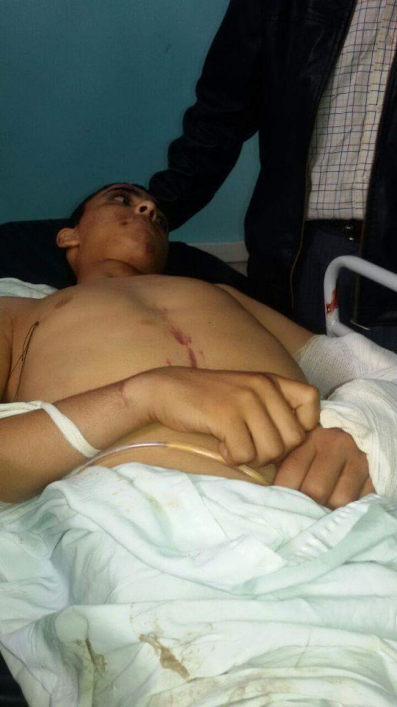أصيب بكسور خطيرة.. التلميذ الذي حاول الانتحار يرقد في مستشفى ابن رشد في كازا (صور)