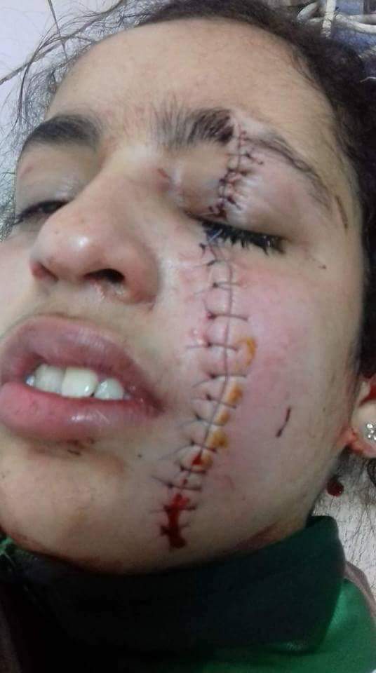 القنيطرة.. تلميذة شرملات زميلتها في المدرسة بزيزوار بسبب مراهق!!