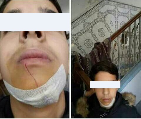 مرتيل.. الاعتداء على تلميذ بأداة حادة