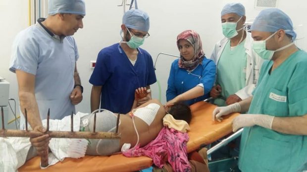 بالصور من أزرو.. تدخل جراحي ينقذ حياة طفلة انغرزت في صدرها قطع حديدية