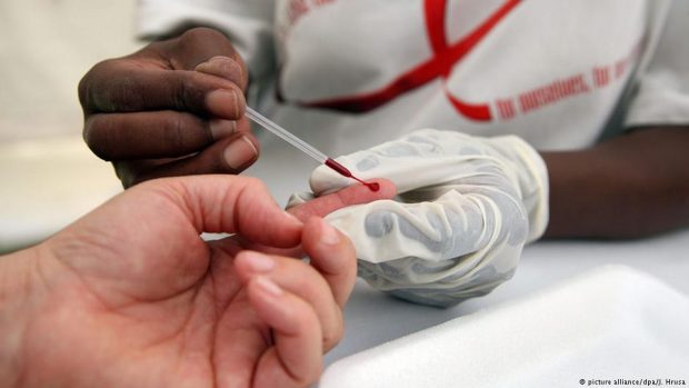 وزارة الصحة: 20 ألف مغربي يحملون فيروس السيدا