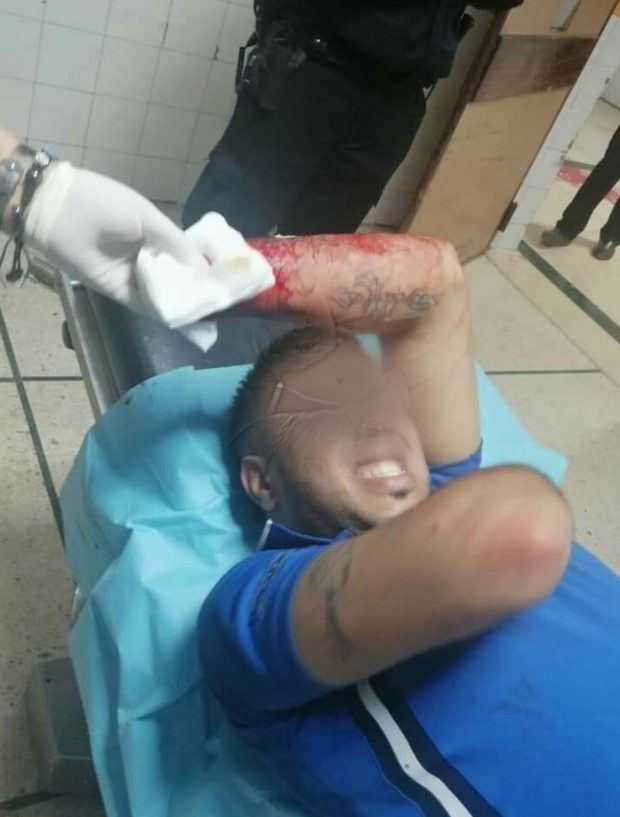 بالصور من أكادير.. شجار ينتهي ببتر يد شاب