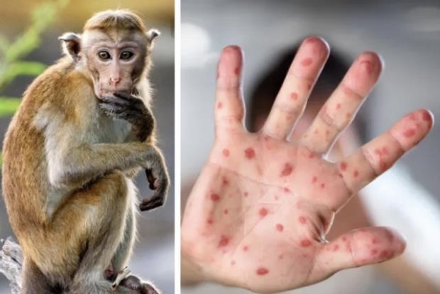 بخصوص التطعيم ضد “جدري القرود”.. بشرى من منظمة الصحة العالمية