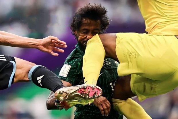 بعد الإصابة الخطيرة للشهراني في مباراة السعودية والأرجنتين.. ولي العهد السعودي يتدخل (صور)